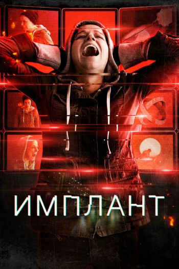 Смотреть онлайн Имплант